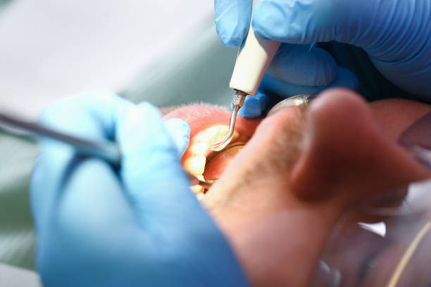 Best Pediatric Emergency Dentist in Massillon, OH