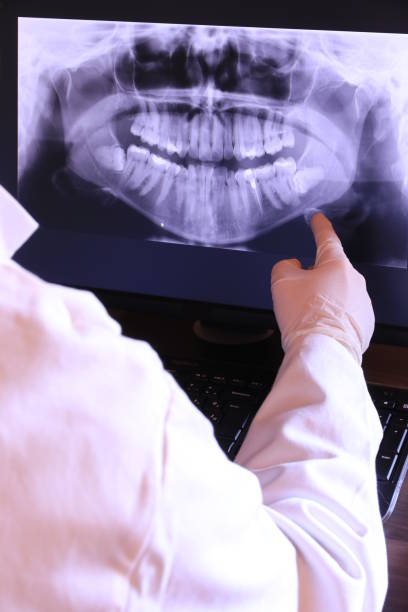 Best Emergency Denture Repair in Massillon, OH