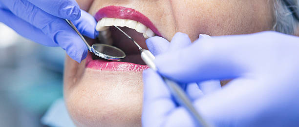 Best Emergency Treatment for Dental Infections or Abscesses in Massillon, OH